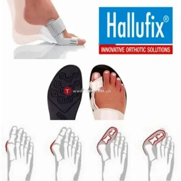 Hallufix Hallux Valgus